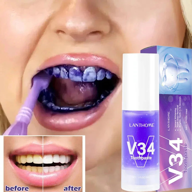 Teeth Whitening Pen