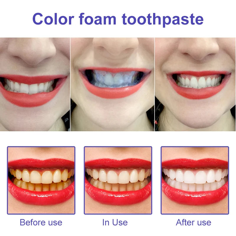 Probiotic Whitening Toothpaste