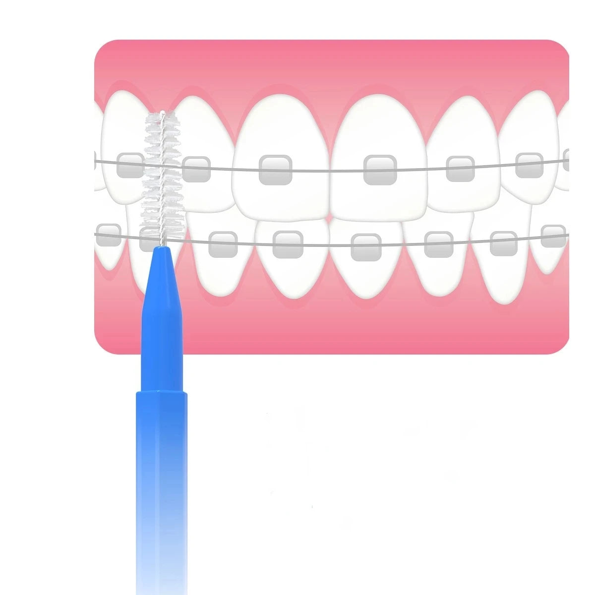 Interdental brushes for cleaning teeth and braces care